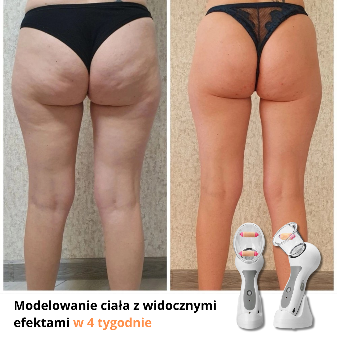 Masażer wyszczuplający SoftSkin